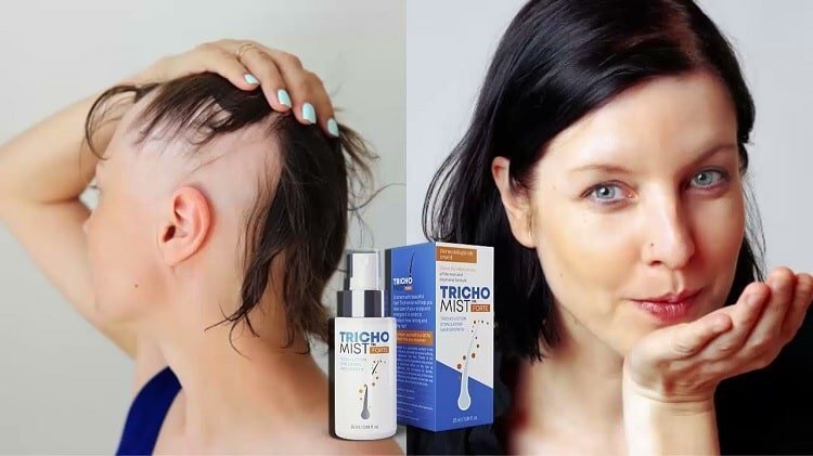 Trichomist Forte - Nowy Lek na Zaburzenia Trądu w Polsce